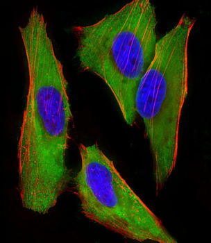 EEF1E1 Mouse Monoclonal Antibody