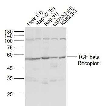 TGF beta Receptor I Rabbit Polyclonal Antibody