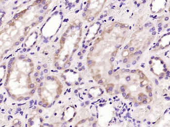 VEGF165 Mouse Monoclonal Antibody