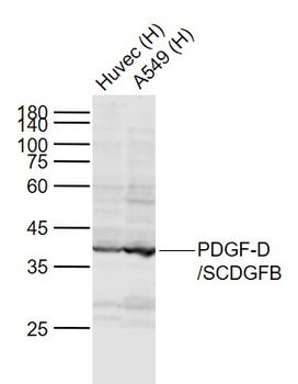 PDGF-D/SCDGFB Rabbit Polyclonal Antibody