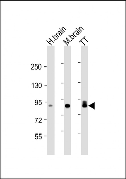 DCAMKL1 Mouse Monoclonal Antibody