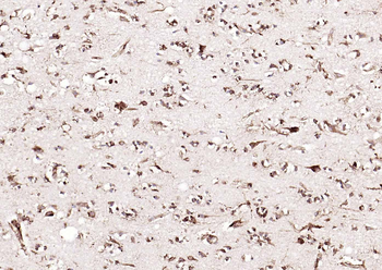Calreticulin Mouse Monoclonal Antibody