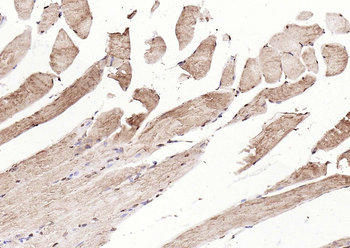 Calreticulin Mouse Monoclonal Antibody