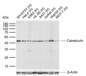 Calreticulin Mouse Monoclonal Antibody