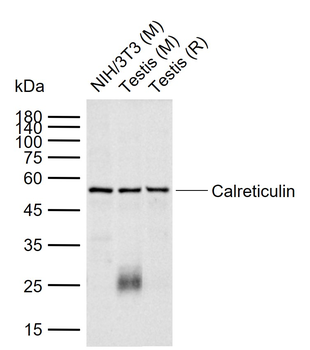 Calreticulin Mouse Monoclonal Antibody