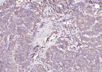 Calreticulin Mouse Monoclonal Antibody