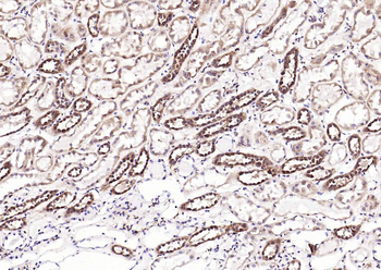 Calreticulin Mouse Monoclonal Antibody