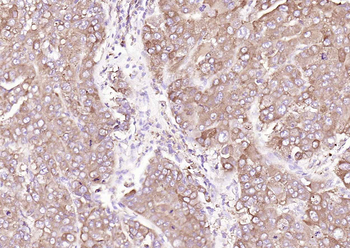 Calreticulin Mouse Monoclonal Antibody