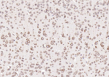 Calreticulin Mouse Monoclonal Antibody