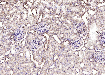 Calreticulin Mouse Monoclonal Antibody