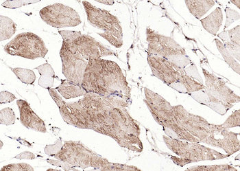 Calreticulin Mouse Monoclonal Antibody