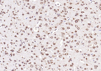 Calreticulin Mouse Monoclonal Antibody