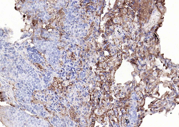 Human Ig Kappa light chain Recombinant Rabbit Monoclonal Antibody