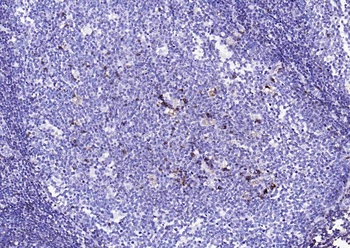 Human Ig Kappa light chain Recombinant Rabbit Monoclonal Antibody