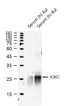Human Ig Kappa light chain Recombinant Rabbit Monoclonal Antibody