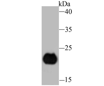 DDAH2 Recombinant Rabbit Monoclonal Antibody