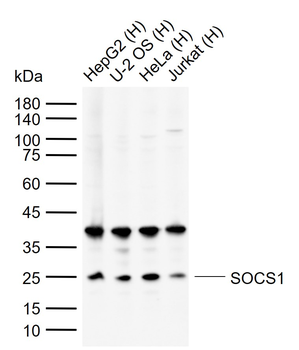 SOCS1 Rabbit Polyclonal Antibody