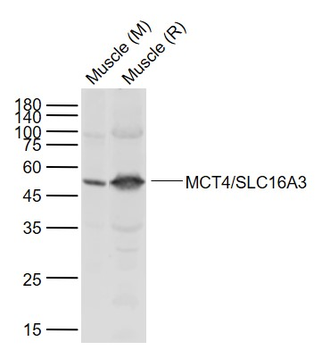 MCT4/SLC16A3 Rabbit Polyclonal Antibody