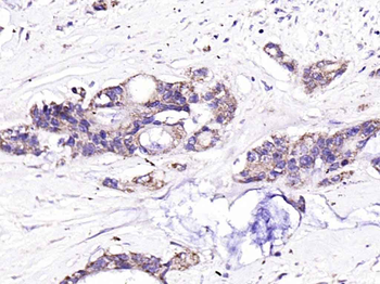 EML4 Rabbit Polyclonal Antibody