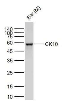 CK10 Rabbit Polyclonal Antibody