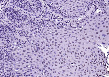 Histone H3 (acetyl K4) Rabbit Polyclonal Antibody