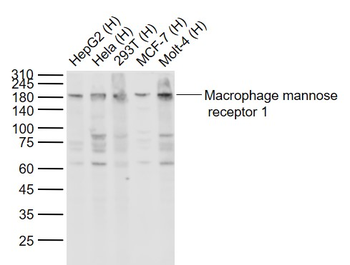 MRC1 Recombinant Rabbit Monoclonal Antibody