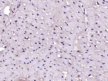 HIF 2 alpha Rabbit Polyclonal Antibody