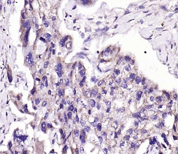 Patched Rabbit Polyclonal Antibody