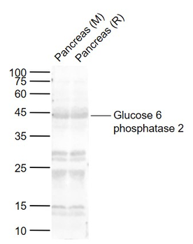 Glucose 6 phosphatase 2 Rabbit Polyclonal Antibody