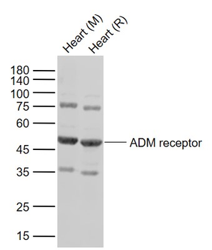 ADM receptor Rabbit Polyclonal Antibody