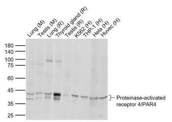 PAR4 Rabbit Polyclonal Antibody