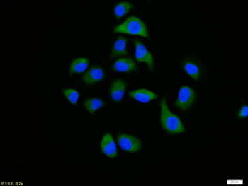 Phospho-IRS-2 (Ser731) Rabbit Polyclonal Antibody