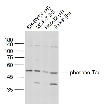 Phospho-Tau (Thr217) Rabbit Polyclonal Antibody