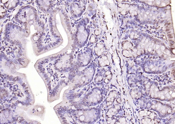 DNase gamma Rabbit Polyclonal Antibody