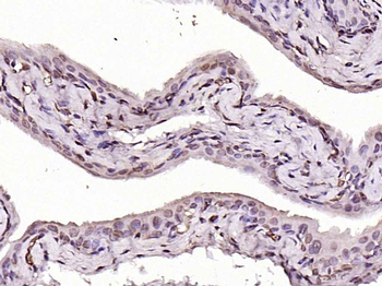 MYCL Rabbit Polyclonal Antibody