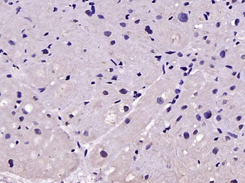 Myozenin 1 Rabbit Polyclonal Antibody