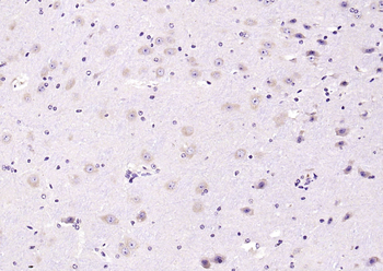 LIP5 Rabbit Polyclonal Antibody