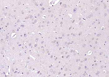LIP5 Rabbit Polyclonal Antibody