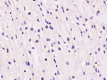 KLF2 Rabbit Polyclonal Antibody