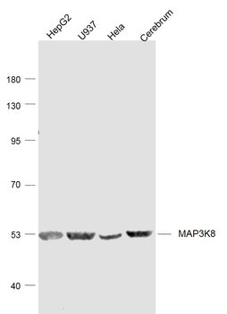 MAP3K8 Rabbit Polyclonal Antibody