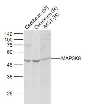 MAP3K8 Rabbit Polyclonal Antibody