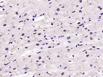 STAT3 Rabbit Polyclonal Antibody