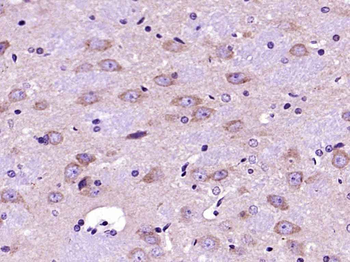 NMDAR2B Rabbit Polyclonal Antibody