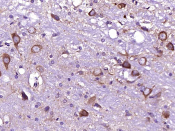 NMDAR2B Rabbit Polyclonal Antibody