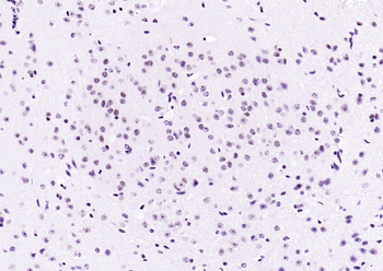 API5 Rabbit Polyclonal Antibody