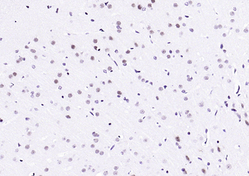 API5 Rabbit Polyclonal Antibody