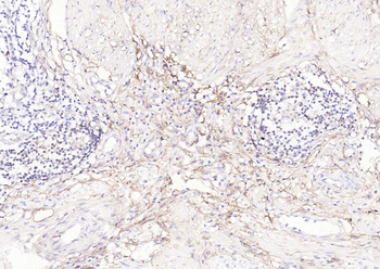 CD73 Mouse Monoclonal Antibody