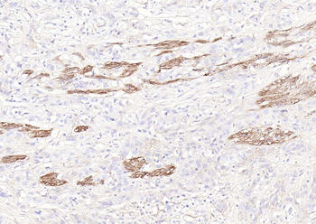 CD73 Mouse Monoclonal Antibody