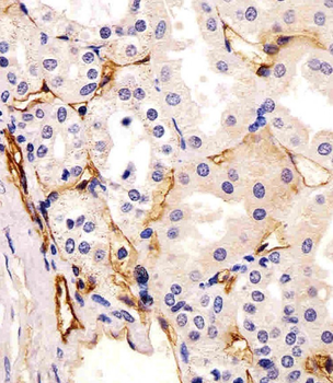 CD73 Mouse Monoclonal Antibody