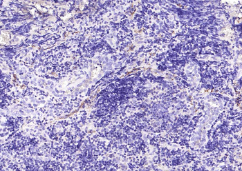 CD73 Mouse Monoclonal Antibody